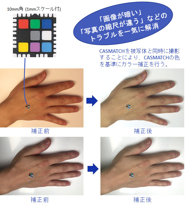 オンライン診療時の画像の色を補正するサービスの提供を開始 ニュース Dnp 大日本印刷